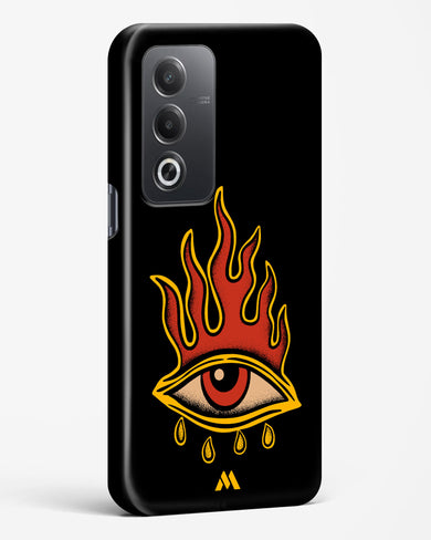 Blaze Vision Hard Case Phone Cover (Oppo)