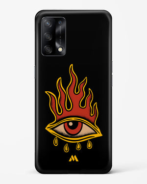 Blaze Vision Hard Case Phone Cover-(Oppo)