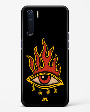 Blaze Vision Hard Case Phone Cover-(Oppo)