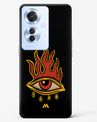 Blaze Vision Hard Case Phone Cover (Oppo)