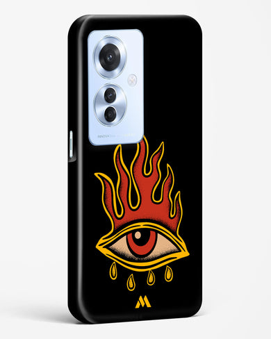 Blaze Vision Hard Case Phone Cover (Oppo)