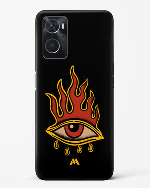 Blaze Vision Hard Case Phone Cover (Oppo)