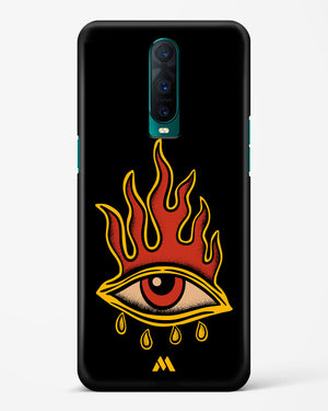 Blaze Vision Hard Case Phone Cover (Oppo)