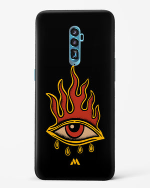 Blaze Vision Hard Case Phone Cover-(Oppo)