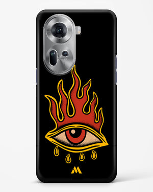 Blaze Vision Hard Case Phone Cover (Oppo)