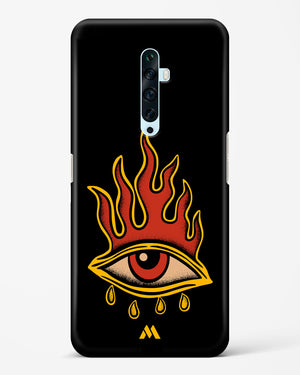 Blaze Vision Hard Case Phone Cover-(Oppo)