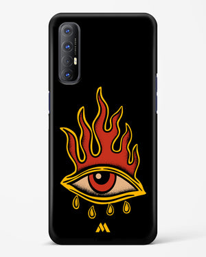 Blaze Vision Hard Case Phone Cover (Oppo)