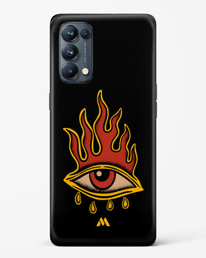 Blaze Vision Hard Case Phone Cover-(Oppo)