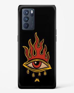 Blaze Vision Hard Case Phone Cover (Oppo)