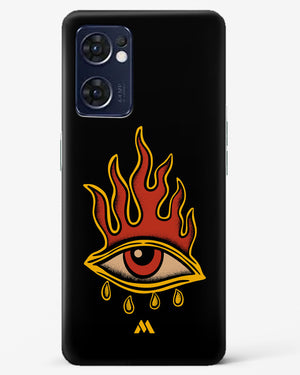Blaze Vision Hard Case Phone Cover (Oppo)