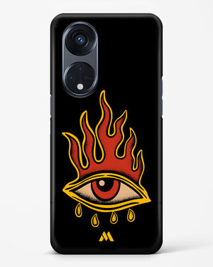 Blaze Vision Hard Case Phone Cover-(Oppo)