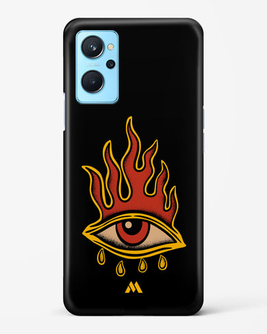 Blaze Vision Hard Case Phone Cover-(Realme)