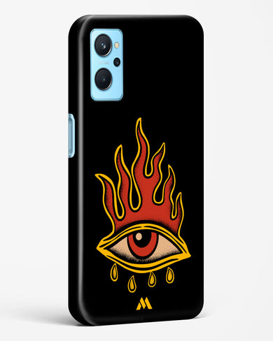 Blaze Vision Hard Case Phone Cover-(Realme)