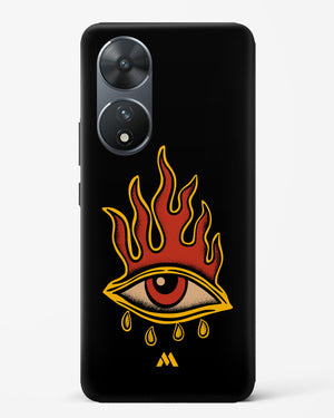 Blaze Vision Hard Case Phone Cover (Vivo)