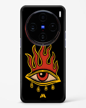 Blaze Vision Hard Case Phone Cover (Vivo)
