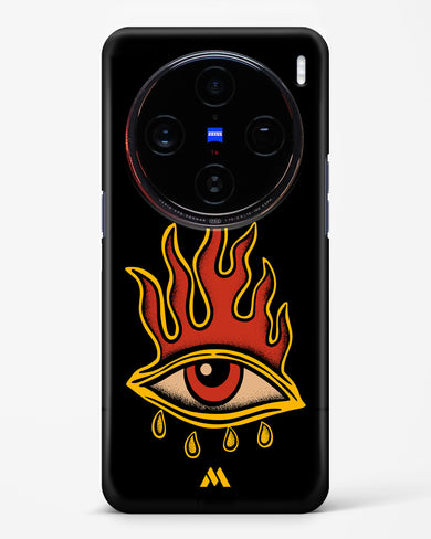 Blaze Vision Hard Case Phone Cover (Vivo)