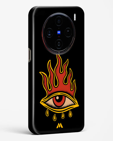 Blaze Vision Hard Case Phone Cover (Vivo)