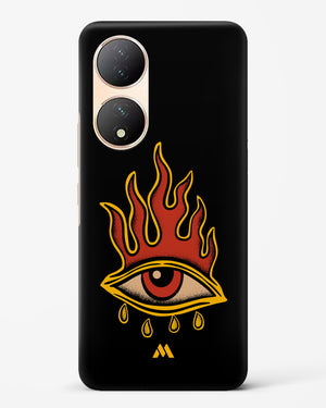 Blaze Vision Hard Case Phone Cover (Vivo)