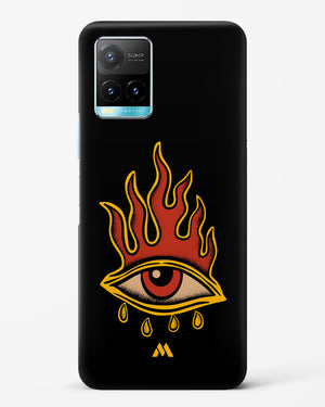 Blaze Vision Hard Case Phone Cover-(Vivo)