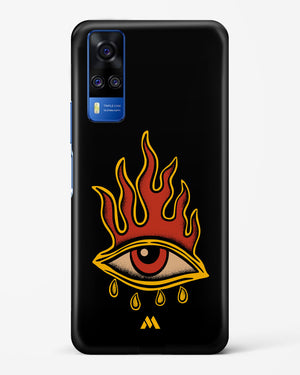 Blaze Vision Hard Case Phone Cover (Vivo)