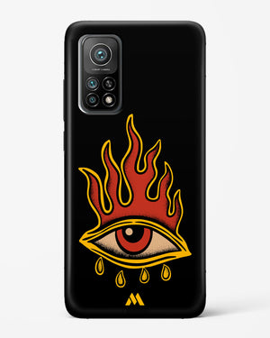Blaze Vision Hard Case Phone Cover (Xiaomi)