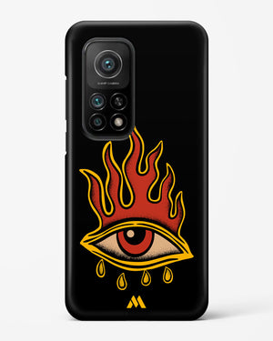 Blaze Vision Hard Case Phone Cover-(Xiaomi)