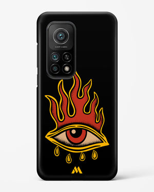Blaze Vision Hard Case Phone Cover (Xiaomi)