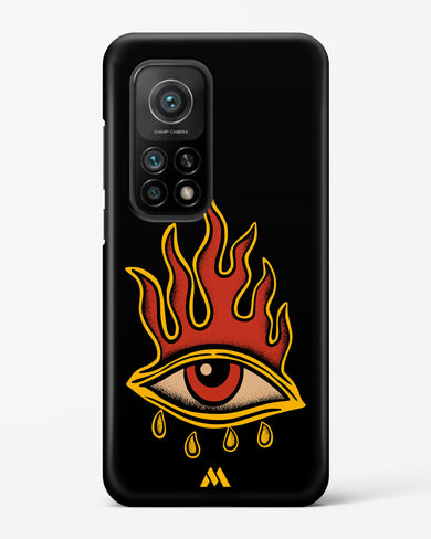 Blaze Vision Hard Case Phone Cover-(Xiaomi)