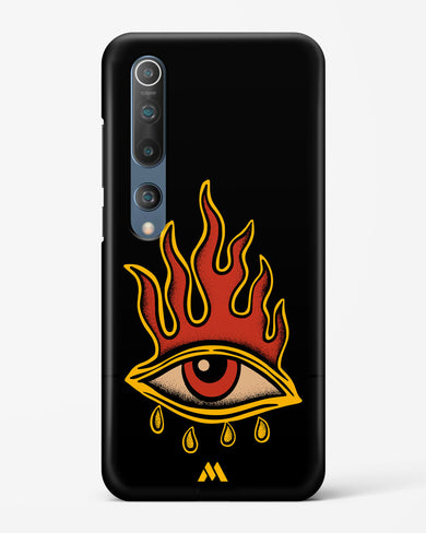 Blaze Vision Hard Case Phone Cover-(Xiaomi)