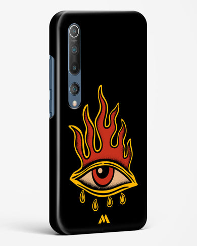 Blaze Vision Hard Case Phone Cover-(Xiaomi)