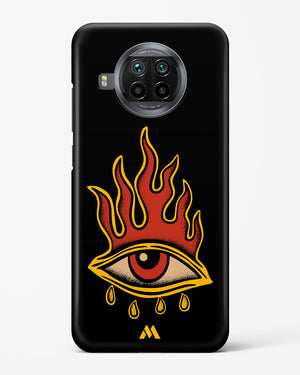 Blaze Vision Hard Case Phone Cover-(Xiaomi)