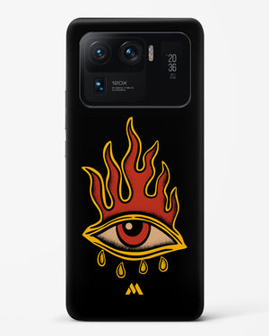 Blaze Vision Hard Case Phone Cover-(Xiaomi)