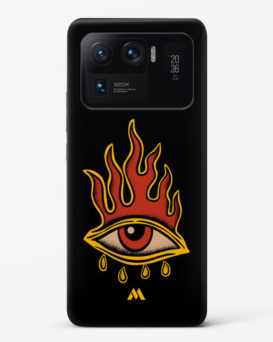 Blaze Vision Hard Case Phone Cover-(Xiaomi)