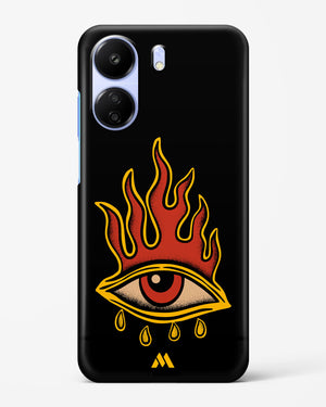 Blaze Vision Hard Case Phone Cover (Xiaomi)