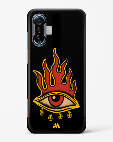 Blaze Vision Hard Case Phone Cover-(Xiaomi)