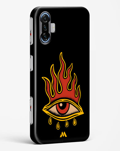 Blaze Vision Hard Case Phone Cover-(Xiaomi)