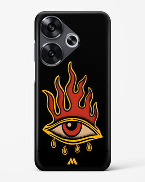 Blaze Vision Hard Case Phone Cover (Xiaomi)