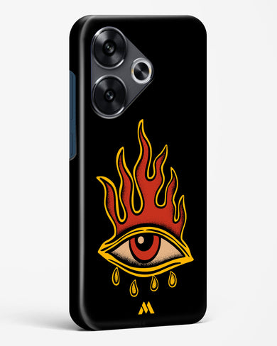 Blaze Vision Hard Case Phone Cover (Xiaomi)