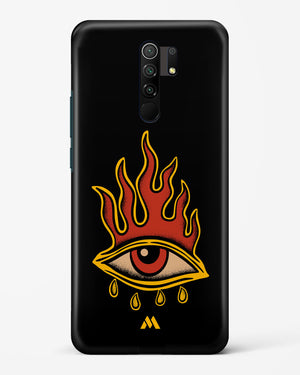 Blaze Vision Hard Case Phone Cover (Xiaomi)
