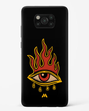 Blaze Vision Hard Case Phone Cover (Xiaomi)