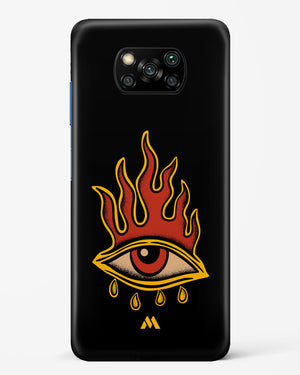 Blaze Vision Hard Case Phone Cover-(Xiaomi)