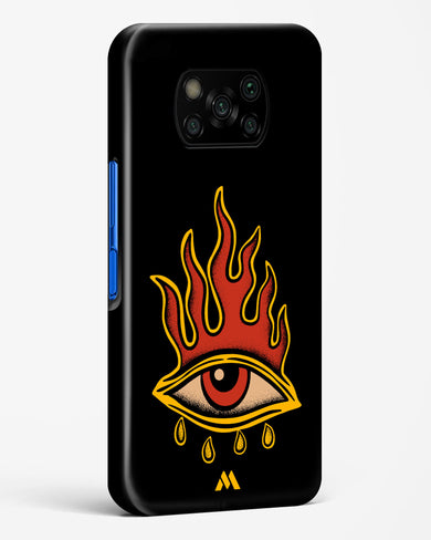 Blaze Vision Hard Case Phone Cover-(Xiaomi)