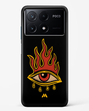 Blaze Vision Hard Case Phone Cover (Xiaomi)