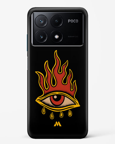 Blaze Vision Hard Case Phone Cover (Xiaomi)