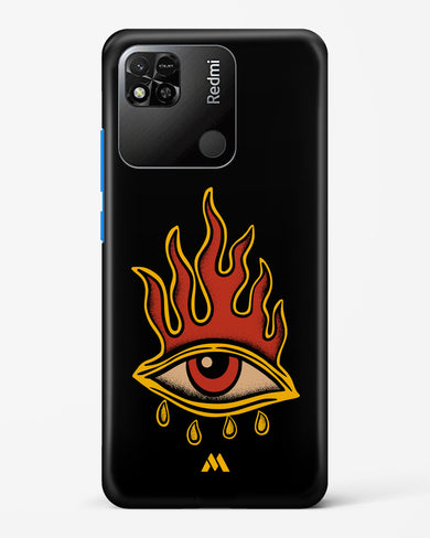 Blaze Vision Hard Case Phone Cover-(Xiaomi)