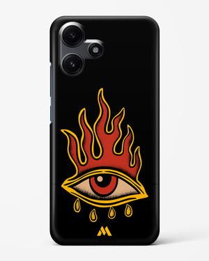 Blaze Vision Hard Case Phone Cover (Xiaomi)