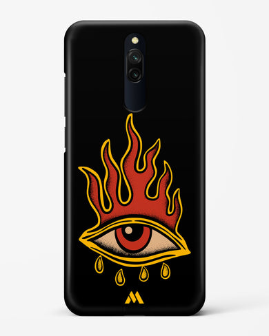 Blaze Vision Hard Case Phone Cover-(Xiaomi)