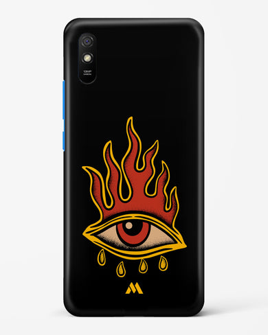 Blaze Vision Hard Case Phone Cover-(Xiaomi)