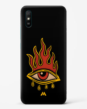 Blaze Vision Hard Case Phone Cover-(Xiaomi)