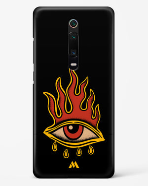 Blaze Vision Hard Case Phone Cover-(Xiaomi)